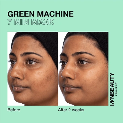Shop Innbeauty Project Green Machine Innsta-glo Aha & Bha Resurfacing Mask