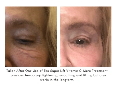 Maya Chia The Super Lift Vitamin C-more Treatment