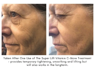 Maya Chia The Super Lift Vitamin C-more Treatment