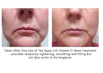 Maya Chia The Super Lift Vitamin C-more Treatment