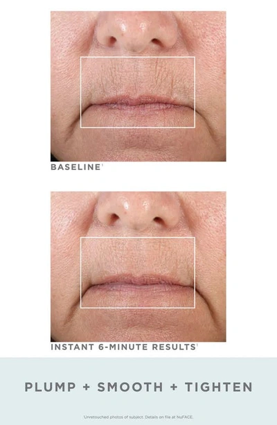 Nuface Fix Line Smoothing Device