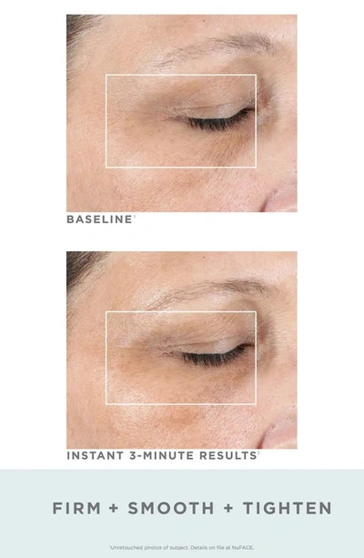 Nuface Fix Line Smoothing Device