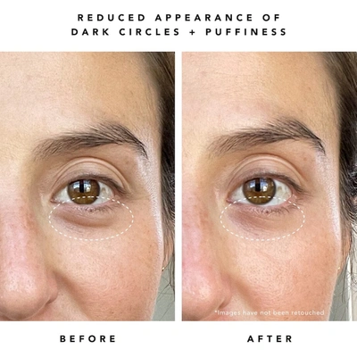 Herbivore Botanicals Super Nova 5% Thd Vitamin C Brightening Eye Cream
