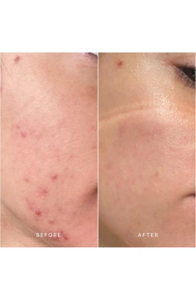 True Botanicals Clear Pure Radiance Oil