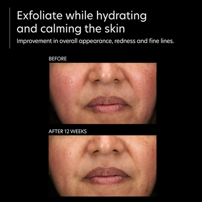 Pca Skin Resurfacing Serum In Default Title