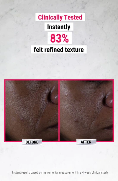 Kiehl's Since 1851 Ultra Pure High-potency Serum 9.8% Glycolic Acid