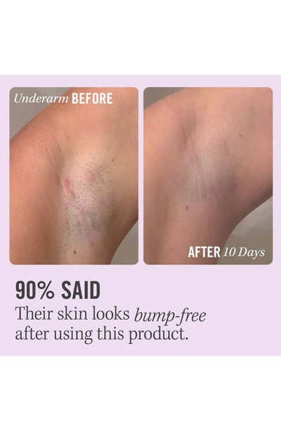 First Aid Beauty Ingrown Hair Pads With Bha & Aha