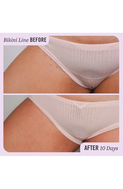 First Aid Beauty Ingrown Hair Pads With Bha & Aha