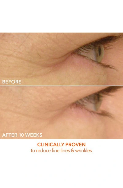 Dr Dennis Gross Skincare Drx Spectralite Led Eye Care Max Pro