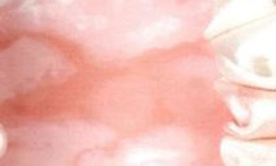 Blissy 3-pack Skinny Silk Scrunchies In Rose White Marble