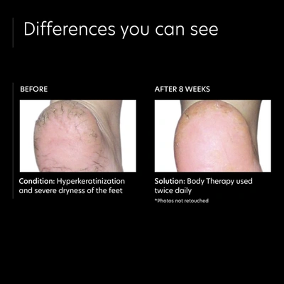Pca Skin Body Therapy In Default Title