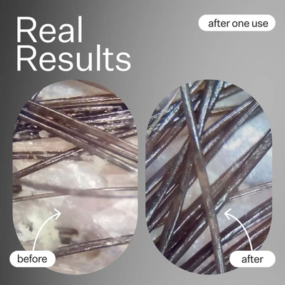 Act+acre Cold Processed Scalp Renew 35ml In Default Title