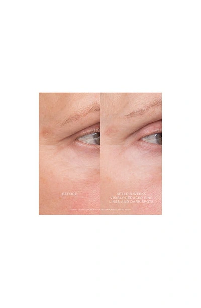 Hourglass Equilibrium Resurfacing Retinoid Treatment