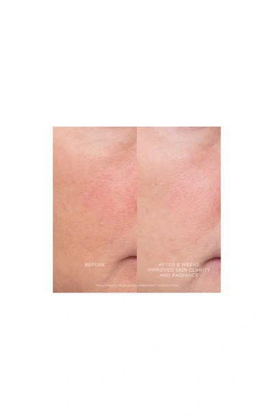 Hourglass Equilibrium Resurfacing Retinoid Treatment