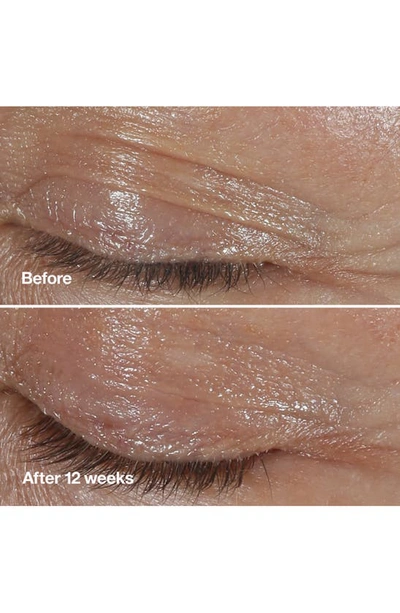 Clinique Smart Clinical Repair Wrinkle Correcting Eye Cream 1 Oz.