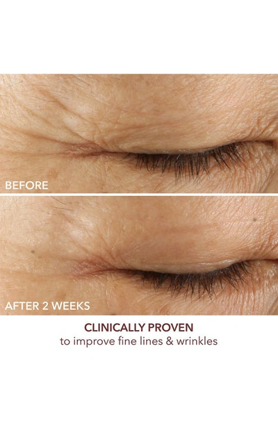 Dr Dennis Gross Dr. Dennis Gross Skincare Advanced Retinol + Ferulic Triple Correction Eye Serum