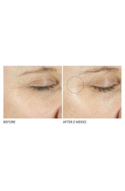 Dr Dennis Gross Dr. Dennis Gross Skincare Advanced Retinol + Ferulic Triple Correction Eye Serum