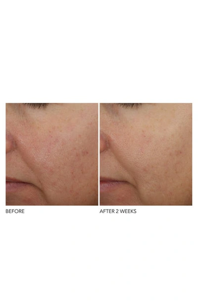 Shop Dr Dennis Gross Advanced Retinol + Ferulic Overnight Wrinkle Treatment