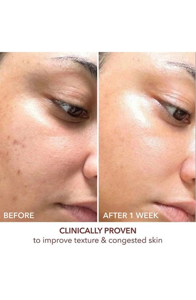 Dr Dennis Gross Dr. Dennis Gross Skincare Advanced Retinol + Ferulic Texture Renwal Serum
