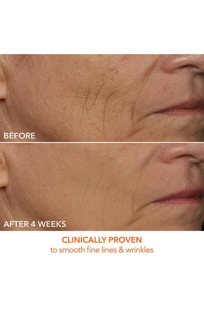 Dr Dennis Gross Dr. Dennis Gross Skincare Drx Spectralite™ Faceware Pro Led Light Therapy Device