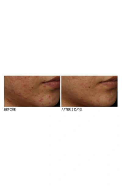 Dr Dennis Gross Dr. Dennis Gross Skincare Drx Spectralite™ Faceware Pro Led Light Therapy Device