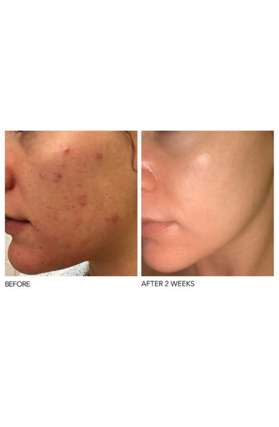 Dr Dennis Gross Dr. Dennis Gross Skincare Alpha Beta® Peel Extra Strength Formula