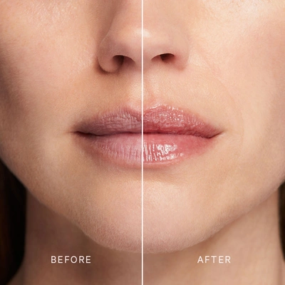 Mz Skin Volumizing Lip Perfector In Default Title