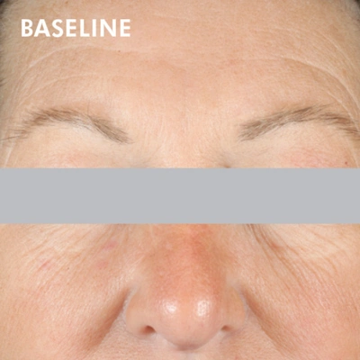 Skinceuticals A.g.e. Interrupter Advanced In Default Title
