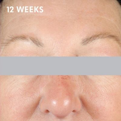 Skinceuticals A.g.e. Interrupter Advanced In Default Title