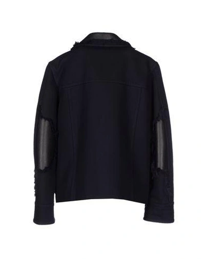 Shop Alexander Wang Jacket In Dark Blue