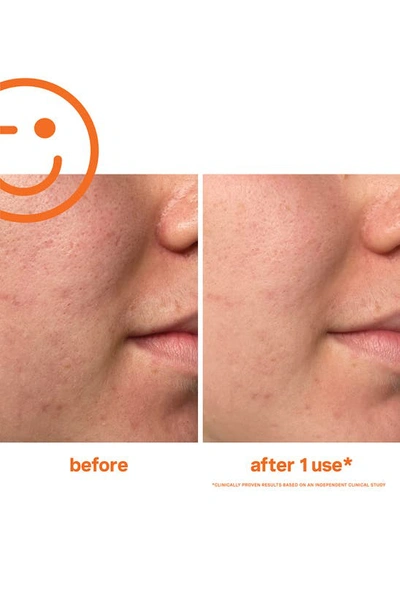Kate Somerviller Kate Somerville® Exfolikate® Intensive Exfoliating Treatment