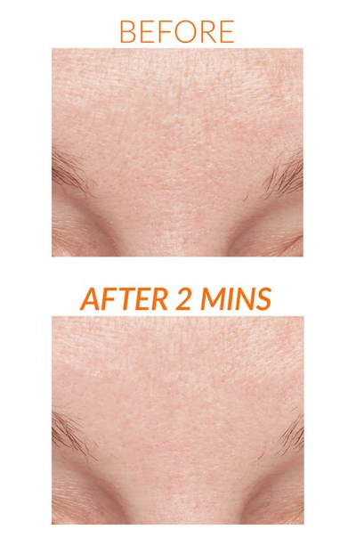 Kate Somerviller Kate Somerville® Exfolikate® Intensive Exfoliating Treatment