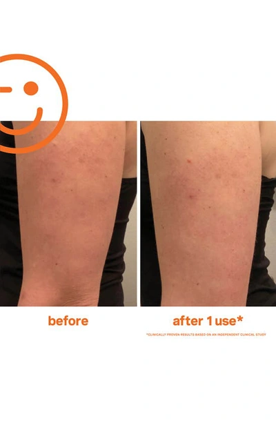 Kate Somerville 5 Oz. Exfolikate Resurfacing Body Scrub