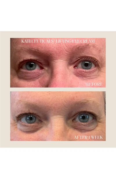 Kate Somerviller Kate Somerville® Kateceuticals® Lifting Eye Cream