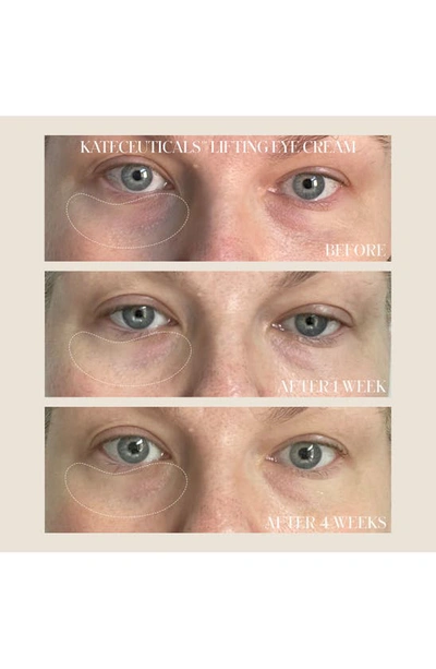 Kate Somerviller Kate Somerville® Kateceuticals® Lifting Eye Cream