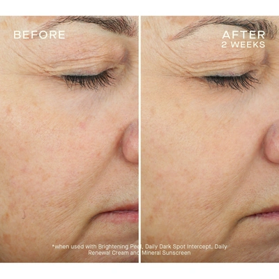 Ourself Brightening Peel Kit In Default Title