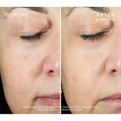 Ourself Brightening Peel Kit In Default Title