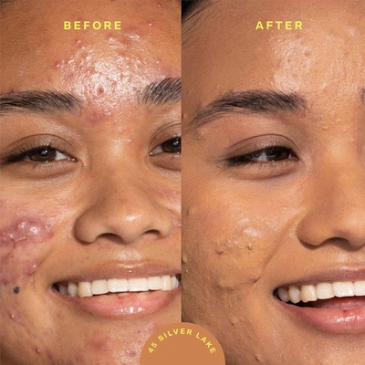 Tower 28 Sunnydays Tinted Spf Sunscreen Foundation