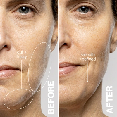 Dermaflash Luxe+ Advanced Sonic Dermaplaning And Peach Fuzz Removal - Pop Pink In Pop Pink