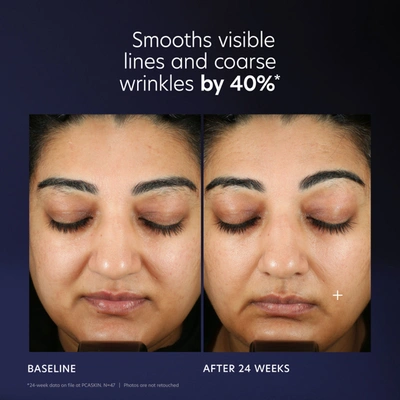 Pca Skin Pro-max Age Renewal In Default Title