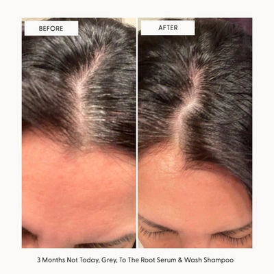 Arey To The Root Serum
