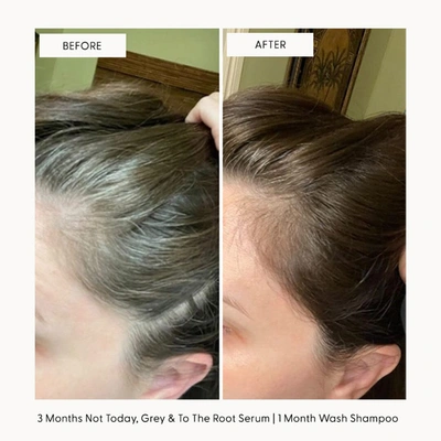 Arey To The Root Serum
