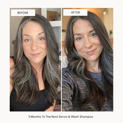 Arey To The Root Serum