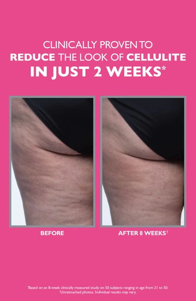 Shop Peter Thomas Roth Firmx® Tight & Toned Cellulite Treatment