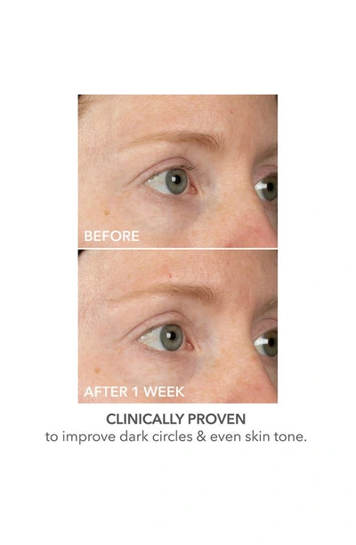 Dr Dennis Gross Skincare Dr. Dennis Gross Skincare Derminfusions Lift And Repair Eye Mask