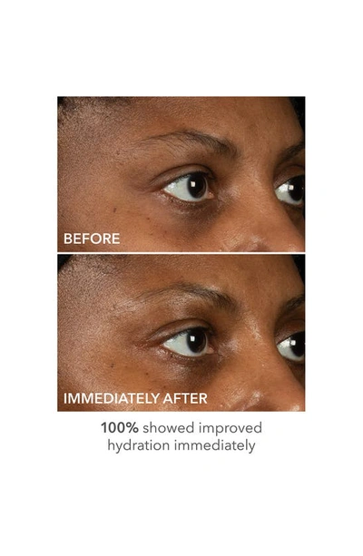 Dr Dennis Gross Skincare Dr. Dennis Gross Skincare Derminfusions Lift And Repair Eye Mask
