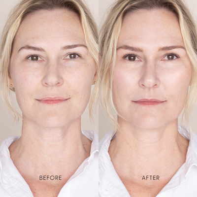 Iris & Romeo Best Skin Days Treatment Concealer
