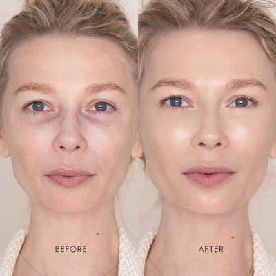 Iris & Romeo Best Skin Days Treatment Concealer