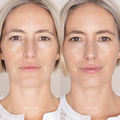 Iris & Romeo Best Skin Days Treatment Concealer