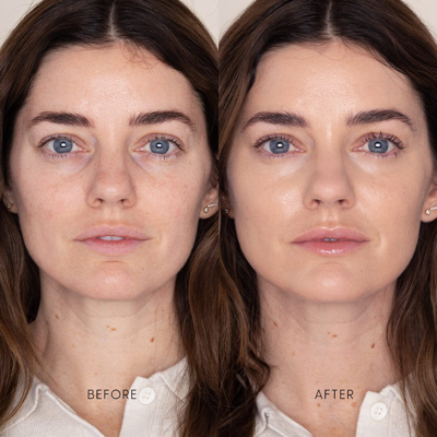 Iris & Romeo Best Skin Days Treatment Concealer